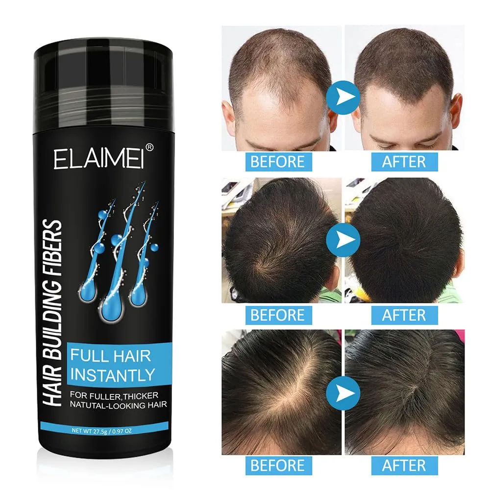 - 27.5g Bottle - Conceals Hair Loss in Seconds - Hair Powder for Women & Men,Fill In Fine or Thinning Hair Instantly Thicker (Black) Hair radioactivity ceiling leg coincidence observatory race Fibers for Thinning Hair & Bald Spots 
