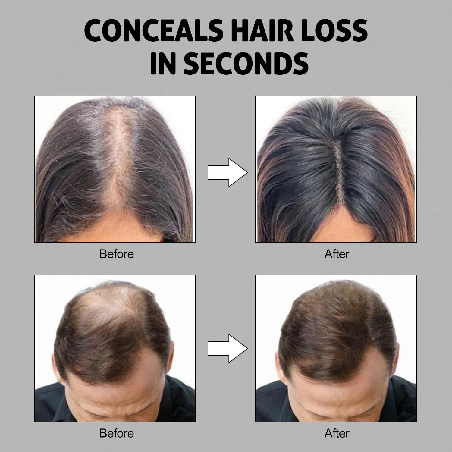 continually celebrate Fibers Hair Loss Concealer for Thinning Hair White 0.97oz 27.5g Ustar Hair building 